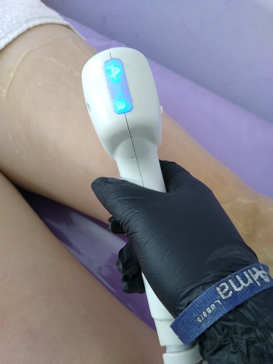 Sesión de depilación láser definitiva en Bellezza Definitiva, centro de estética en Ituzaingó